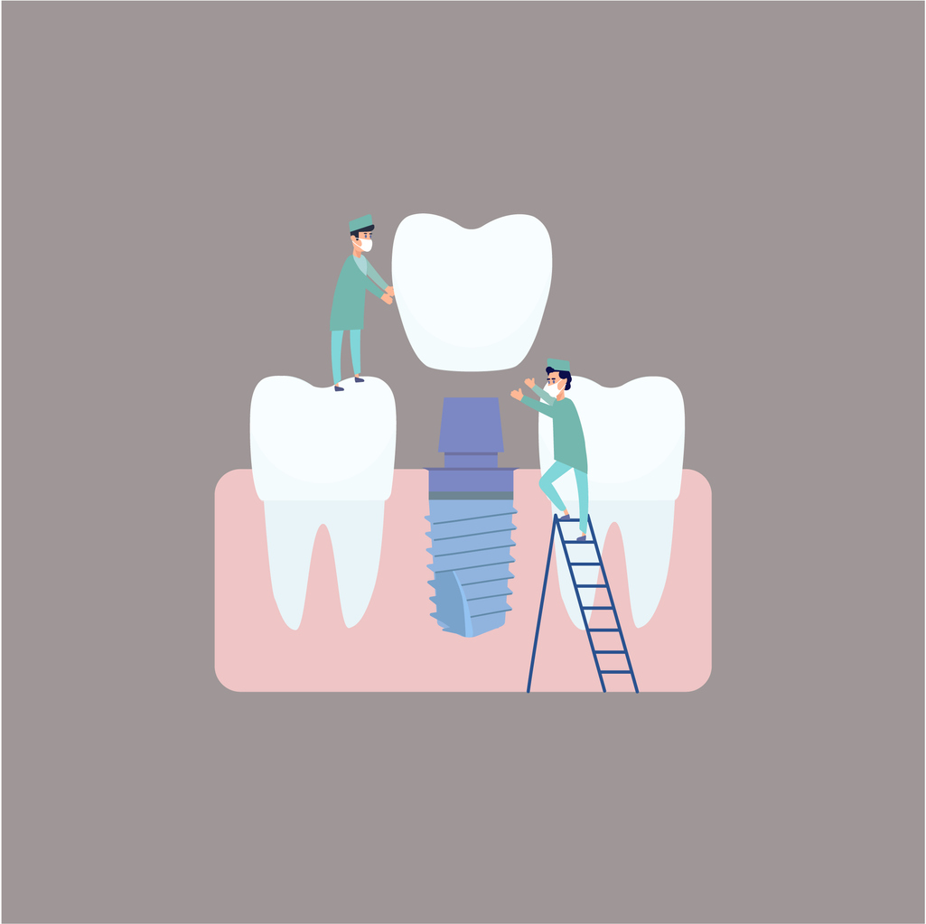 concept image fo dental implants for one persone