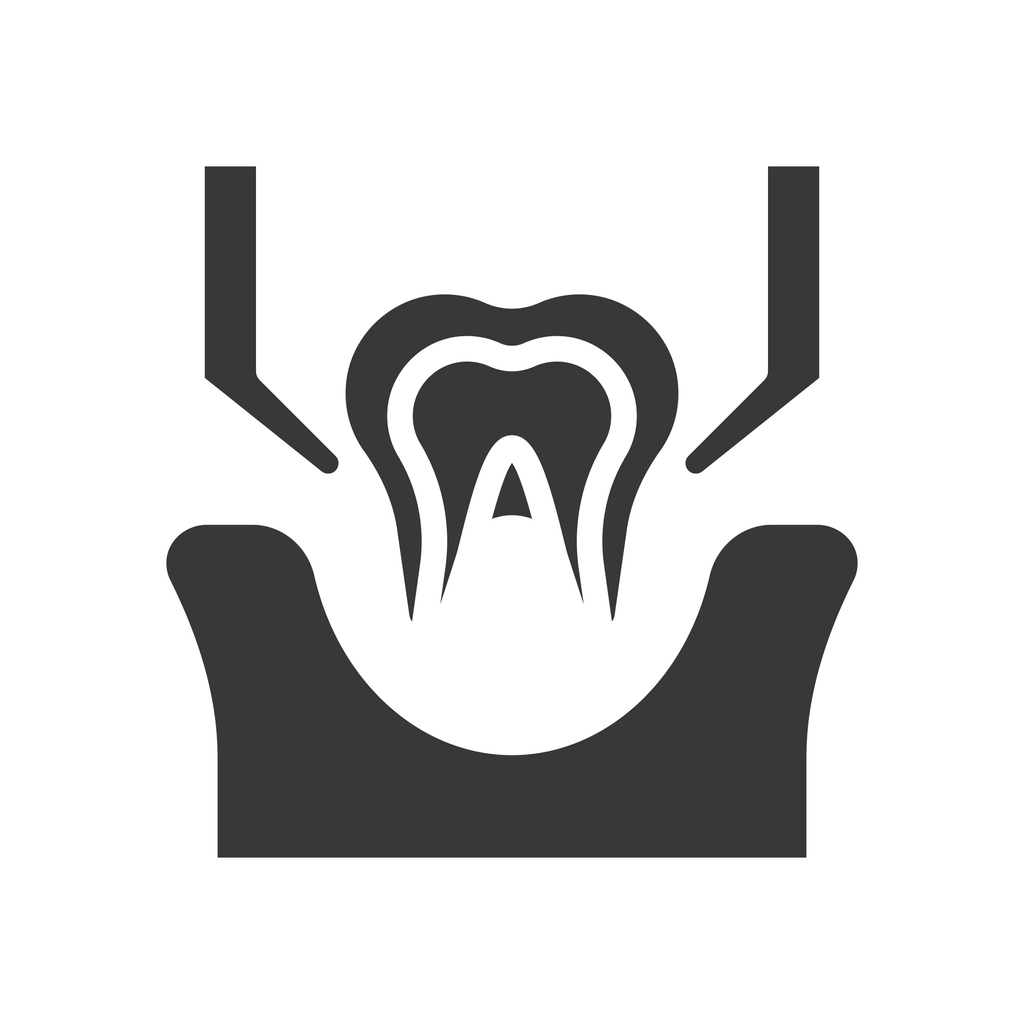 featured image for 4 situations where you need a tooth pulled